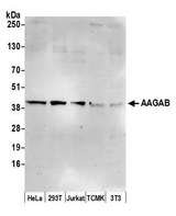 AAGAB Antibody - Detection of human and mouse AAGAB by western blot. Samples: Whole cell lysate (15 µg) from HeLa, HEK293T, Jurkat, mouse TCMK-1, and mouse NIH 3T3 cells prepared using NETN lysis buffer. Antibody: Affinity purified rabbit anti-AAGAB antibody used for WB at 1:1000. Detection: Chemiluminescence with an exposure time of 30 seconds.