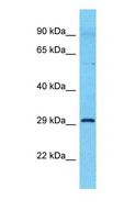 AAGAB Antibody - Western blot of AAGAB Antibody with PANC1 Whole Cell lysate.  This image was taken for the unconjugated form of this product. Other forms have not been tested.