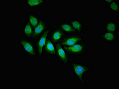 AAGAB Antibody - Immunofluorescent analysis of A549 cells at a dilution of 1:100 and Alexa Fluor 488-congugated AffiniPure Goat Anti-Rabbit IgG(H+L)