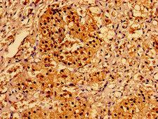 AAGAB Antibody - Immunohistochemistry image of paraffin-embedded human adrenal gland tissue at a dilution of 1:100
