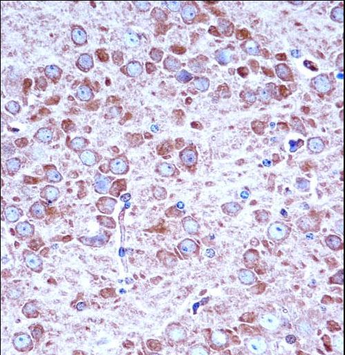 AAK1 Antibody - Mouse Aak1 Antibody immunohistochemistry of formalin-fixed and paraffin-embedded mouse brain tissue followed by peroxidase-conjugated secondary antibody and DAB staining.