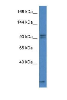 AAK1 Antibody - AAK1 antibody Western blot of Mouse Thymus lysate. Antibody concentration 1 ug/ml.  This image was taken for the unconjugated form of this product. Other forms have not been tested.