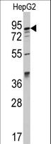 AAK1 Antibody - Western blot of anti-AAK1 Antibody in HepG2 cell line lysates (35 ug/lane). AAK1 (arrow) was detected using the purified antibody.