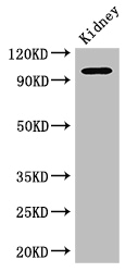 AAK1 Antibody - Positive WB detected in:Mouse kidney tissue;All lanes: AAK1 antibody at 2.5ug/ml;Secondary;Goat polyclonal to rabbit IgG at 1/50000 dilution;Predicted band size: 104,94 kDa;Observed band size: 104 kDa;