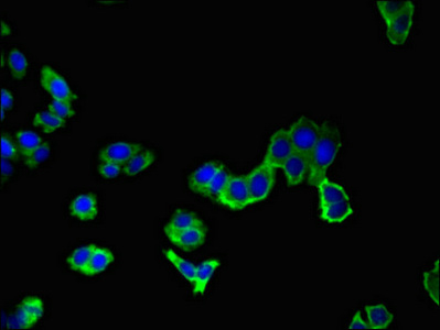 AAK1 Antibody - Immunofluorescent analysis of HepG2 cells using AAK1 Antibody at dilution of 1:100 and Alexa Fluor 488-congugated AffiniPure Goat Anti-Rabbit IgG(H+L)