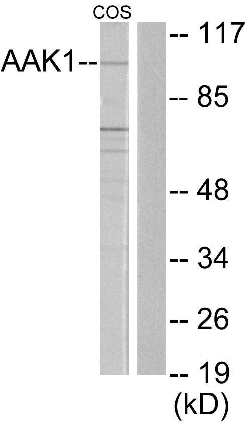 AAK1 Antibody - Western blot analysis of extracts from COS7 cells, using AAK1 antibody.