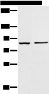 AAK1 Antibody - Western blot analysis of 293T cell and Human left kidney tissue  using AAK1 Polyclonal Antibody at dilution of 1:400