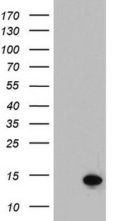 AAMDC Antibody - HEK293T cells were transfected with the pCMV6-ENTRY control (Left lane) or pCMV6-ENTRY C11orf67 (Right lane) cDNA for 48 hrs and lysed. Equivalent amounts of cell lysates (5 ug per lane) were separated by SDS-PAGE and immunoblotted with anti-C11orf67.
