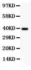 AAMP Antibody - AAMP antibody Western blot. All lanes: Anti AAMP at 0.5 ug/ml. WB: Recombinant Human AAMP Protein 0.5ng. Predicted band size: 39 kD. Observed band size: 39 kD.