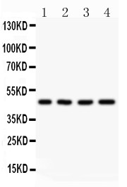 AAMP Antibody - AAMP antibody Western blot. All lanes: Anti AAMP at 0.5 ug/ml. Lane 1: A431 Whole Cell Lysate at 40 ug. Lane 2: HELA Whole Cell Lysate at 40 ug. Lane 3: HEPG2 Whole Cell Lysate at 40 ug. Lane 4: MCF-7 Whole Cell Lysate at 40 ug. Predicted band size: 47 kD. Observed band size: 47 kD.