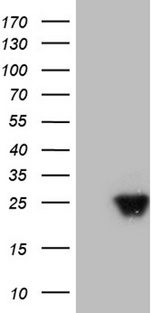 AANAT Antibody - HEK293T cells were transfected with the pCMV6-ENTRY control. (Left lane) or pCMV6-ENTRY AANAT. (Right lane) cDNA for 48 hrs and lysed. Equivalent amounts of cell lysates. (5 ug per lane) were separated by SDS-PAGE and immunoblotted with anti-AANAT. (1:2000)