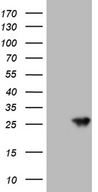 AANAT Antibody - HEK293T cells were transfected with the pCMV6-ENTRY control. (Left lane) or pCMV6-ENTRY AANAT. (Right lane) cDNA for 48 hrs and lysed. Equivalent amounts of cell lysates. (5 ug per lane) were separated by SDS-PAGE and immunoblotted with anti-AANAT. (1:2000)