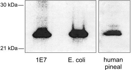 AANAT Antibody - WB: AANAT Antibody - Samples of 1E7 homogenates and bacterially expressed hAANAT were loaded, which contained similar levels of AANAT activity in 65 ug and 2.6 ng of protein.  This image was taken for the unconjugated form of this product. Other forms have not been tested.