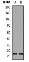 AANAT Antibody - Western blot analysis of AANAT expression in A549 (A); PC12 (B) whole cell lysates.