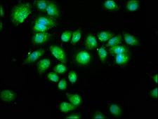 AANAT Antibody - Immunofluorescence staining of A549 cells at a dilution of 1:133, counter-stained with DAPI. The cells were fixed in 4% formaldehyde, permeabilized using 0.2% Triton X-100 and blocked in 10% normal Goat Serum. The cells were then incubated with the antibody overnight at 4 °C.The secondary antibody was Alexa Fluor 488-congugated AffiniPure Goat Anti-Rabbit IgG (H+L) .
