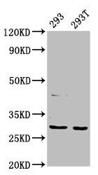 AANAT Antibody - Positive Western Blot detected in 293 whole cell lysate, 293T whole cell lysate. All lanes: AANAT antibody at 7.5 µg/ml Secondary Goat polyclonal to rabbit IgG at 1/50000 dilution. Predicted band size: 24, 29 KDa. Observed band size: 29 KDa