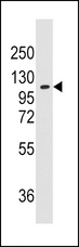 AARS Antibody - Western blot of anti-AARS antibody in K562 cell line lysates (35 ug/lane). AARS (arrow) was detected using the purified antibody.