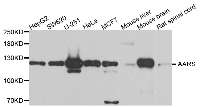 AARS Antibody - Western blot analysis of extracts of various cells.