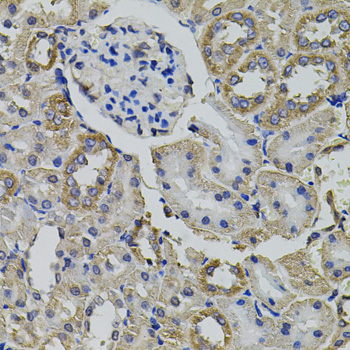 AARS Antibody - Immunohistochemistry of paraffin-embedded rat kidney tissue.