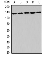 AARS Antibody - Western blot analysis of AlaRS expression in HeLa (A); MCF7 (B); mouse liver (C); mouse brain (D); rat spinal cord (E) whole cell lysates.