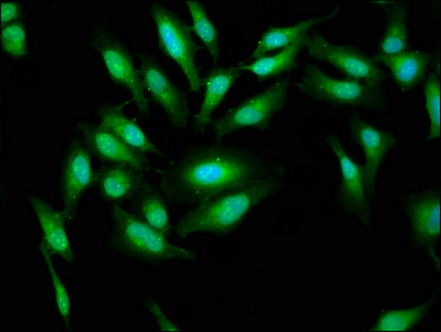 AARS Antibody - Immunofluorescence staining of Hela cells at a dilution of 1:33, counter-stained with DAPI. The cells were fixed in 4% formaldehyde, permeabilized using 0.2% Triton X-100 and blocked in 10% normal Goat Serum. The cells were then incubated with the antibody overnight at 4 °C.The secondary antibody was Alexa Fluor 488-congugated AffiniPure Goat Anti-Rabbit IgG (H+L) .