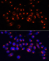 AARS Antibody - Immunofluorescence analysis of 293T cells using AARS antibody at dilution of 1:100 (40x lens). Blue: DAPI for nuclear staining.