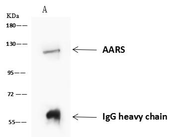 AARS Antibody - AARS was immunoprecipitated using: Lane A: 0.5 mg U-251 MG Whole Cell Lysate. 4 uL anti-AARS rabbit polyclonal antibody and 60 ug of Immunomagnetic beads Protein A/G. Primary antibody: Anti-AARS rabbit polyclonal antibody, at 1:100 dilution. Secondary antibody: Goat Anti-Rabbit IgG (H+L)/HRP at 1/10000 dilution. Developed using the ECL technique. Performed under reducing conditions. Predicted band size: 107 kDa. Observed band size: 107 kDa.