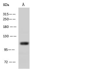 AARS Antibody - Anti-AARS rabbit polyclonal antibody at 1:500 dilution. Lane A: K562 Whole Cell Lysate. Lysates/proteins at 30 ug per lane. Secondary: Goat Anti-Rabbit IgG (H+L)/HRP at 1/10000 dilution. Developed using the ECL technique. Performed under reducing conditions. Predicted band size: 107 kDa. Observed band size: 107 kDa.