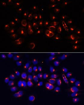 AARS Antibody - Immunofluorescence analysis of 293T cells using AARS Polyclonal Antibody at dilution of 1:100 (40x lens).Blue: DAPI for nuclear staining.