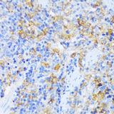 AARS Antibody - Immunohistochemistry of paraffin-embedded Rat spleen using AARS Polyclonal Antibody at dilution of 1:100 (40x lens).
