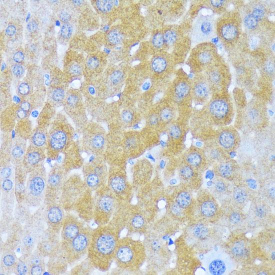 AARS Antibody - Immunohistochemistry of paraffin-embedded Mouse liver using AARS Polyclonal Antibody at dilution of 1:100 (40x lens).