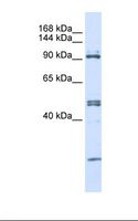 AARS Antibody - 293T cell lysate. Antibody concentration: 1.0 ug/ml. Gel concentration: 6-18%.  This image was taken for the unconjugated form of this product. Other forms have not been tested.