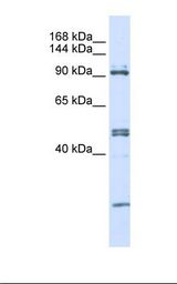 AARS Antibody - 293T cell lysate. Antibody concentration: 1.0 ug/ml. Gel concentration: 6-18%.  This image was taken for the unconjugated form of this product. Other forms have not been tested.