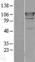 AARS Protein - Western validation with an anti-DDK antibody * L: Control HEK293 lysate R: Over-expression lysate
