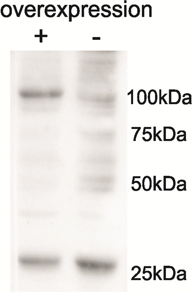 AARS2 Antibody - AARS2 antibody Cell line 143B overexpressing Human AARS2 and probed with (mock transfection in second lane). Data obtained from Henna.Tyynismaa, University of Helsinki, Finland.