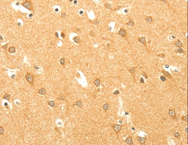 AARS2 Antibody - Immunohistochemistry of paraffin-embedded Human brain using AARS2 Polyclonal Antibody at dilution of 1:40.