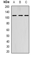AARS2 Antibody - Western blot analysis of AARS2 expression in HepG2 (A); SKOV3 (B); MCF7 (C) whole cell lysates.