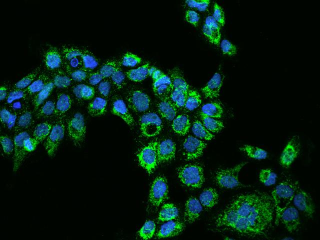 AARS2 Antibody - Immunofluorescence staining of AARS2 in A431 cells. Cells were fixed with 4% PFA, permeabilzed with 0.1% Triton X-100 in PBS, blocked with 10% serum, and incubated with rabbit anti-Human AARS2 polyclonal antibody (dilution ratio 1:200) at 4°C overnight. Then cells were stained with the Alexa Fluor 488-conjugated Goat Anti-rabbit IgG secondary antibody (green) and counterstained with DAPI (blue). Positive staining was localized to Cytoplasm.