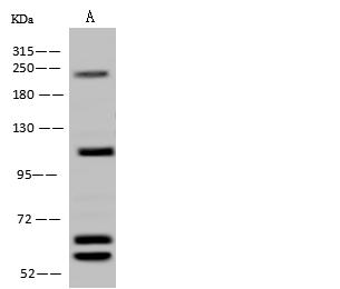 AARS2 Antibody - Anti-AARS2 rabbit polyclonal antibody at 1:500 dilution. Lane A: U-251 MG Whole Cell Lysate. Lysates/proteins at 30 ug per lane. Secondary: Goat Anti-Rabbit IgG (H+L)/HRP at 1/10000 dilution. Developed using the ECL technique. Performed under reducing conditions. Predicted band size: 107 kDa. Observed band size: 107 kDa. (We are unsure as to the identity of these extra bands.)