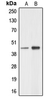AARSD1 Antibody - Western blot analysis of AARSD1 expression in A549 (A); HeLa (B) whole cell lysates.