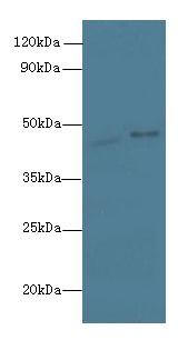 AARSD1 Antibody - Western blot. All lanes: AARSD1 antibody at 0.8 ug/ml. Lane 1: HeLa whole cell lysate. Lane 2: U251 whole cell lysate. Secondary Goat polyclonal to Rabbit IgG at 1:10000 dilution. Predicted band size: 45 kDa. Observed band size: 45 kDa.