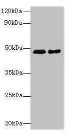 AARSD1 Antibody - Western blot All lanes: AARSD1 antibody at 0.8µg/ml Lane 1: Hela whole cell lysate Lane 2: U251 whole cell lysate Secondary Goat polyclonal to rabbit IgG at 1/10000 dilution Predicted band size: 46, 59, 66 kDa Observed band size: 46 kDa