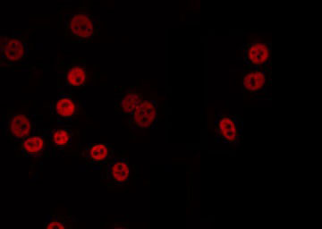 AARSD1 Antibody - Staining A549 cells by IF/ICC. The samples were fixed with PFA and permeabilized in 0.1% Triton X-100, then blocked in 10% serum for 45 min at 25°C. The primary antibody was diluted at 1:200 and incubated with the sample for 1 hour at 37°C. An Alexa Fluor 594 conjugated goat anti-rabbit IgG (H+L) Ab, diluted at 1/600, was used as the secondary antibody.