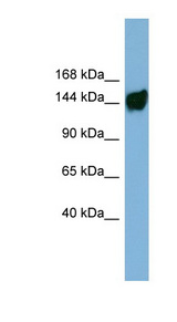 AASDH / ACSF4 Antibody - AASDH antibody Western blot of ACHN lysate. This image was taken for the unconjugated form of this product. Other forms have not been tested.