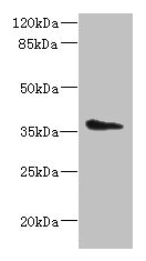 AASDHPPT / LYS5 Antibody - Western blot All lanes: AASDHPPT antibody at 2µg/ml + HepG2 whole cell lysate Secondary Goat polyclonal to rabbit IgG at 1/10000 dilution Predicted band size: 36, 16 kDa Observed band size: 36 kDa