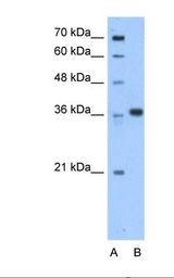 AASDHPPT / LYS5 Antibody - Lane A: Marker. Lane B: HepG2 cell lysate. Antibody concentration: 0.25 ug/ml. Gel concentration: _ 12%.  This image was taken for the unconjugated form of this product. Other forms have not been tested.