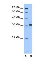 AASDHPPT / LYS5 Antibody - Lane A: Marker. Lane B: HepG2 cell lysate. Antibody concentration: 0.25 ug/ml. Gel concentration: _ 12%.  This image was taken for the unconjugated form of this product. Other forms have not been tested.