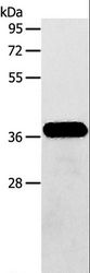 AASDHPPT / LYS5 Antibody - Western blot analysis of Human fetal brain tissue, using AASDHPPT Polyclonal Antibody at dilution of 1:600.
