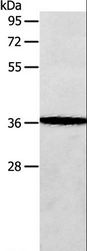 AASDHPPT / LYS5 Antibody - Western blot analysis of Human fetal brain tissue, using AASDHPPT Polyclonal Antibody at dilution of 1:650.