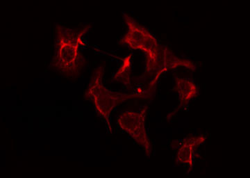 AASDHPPT / LYS5 Antibody - Staining COLO205 cells by IF/ICC. The samples were fixed with PFA and permeabilized in 0.1% Triton X-100, then blocked in 10% serum for 45 min at 25°C. The primary antibody was diluted at 1:200 and incubated with the sample for 1 hour at 37°C. An Alexa Fluor 594 conjugated goat anti-rabbit IgG (H+L) antibody, diluted at 1/600, was used as secondary antibody.